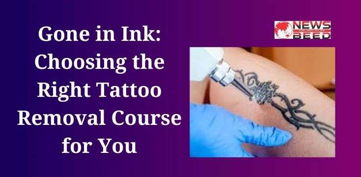 Choosing the Right Tattoo Removal Course for You